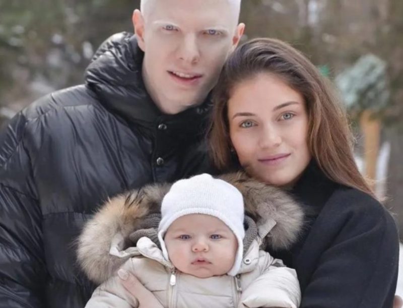 His eyes are sea-blue in colour! What appears to be the albino child of a model and a singer
