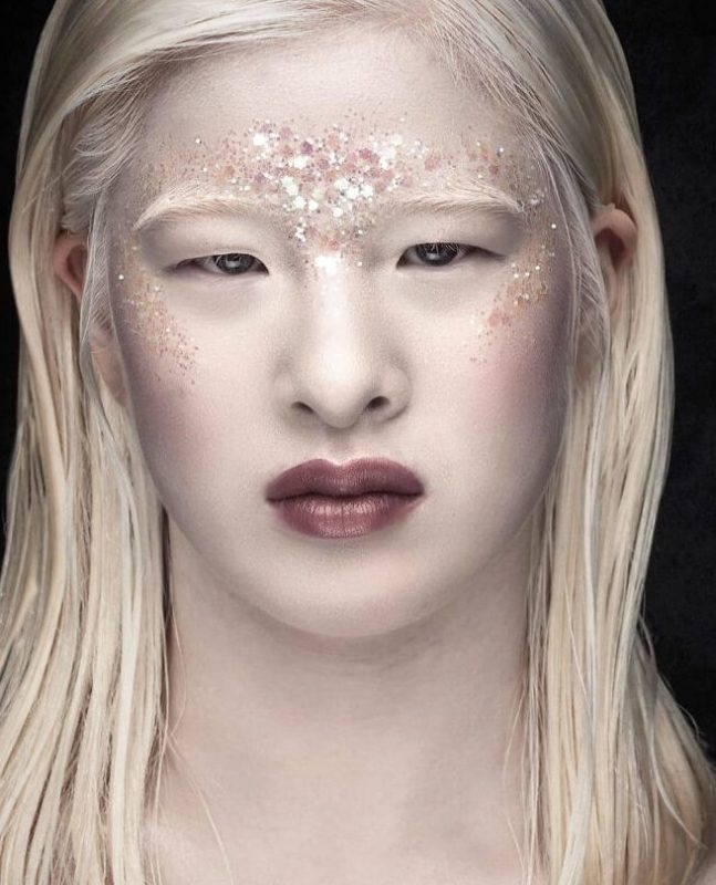 She doesn't have a single friend because of her unusual appearance! That's how it goes