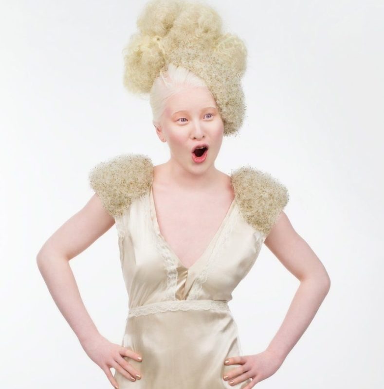 She doesn't have a single friend because of her unusual appearance! That's how it goes
