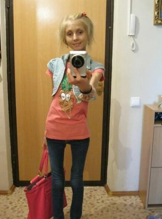 She's reached her breaking point! The life of a girl who weighs 23 kg