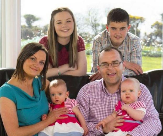 These twins have become popular thanks to a very unusual feature! Here's what they are at the moment