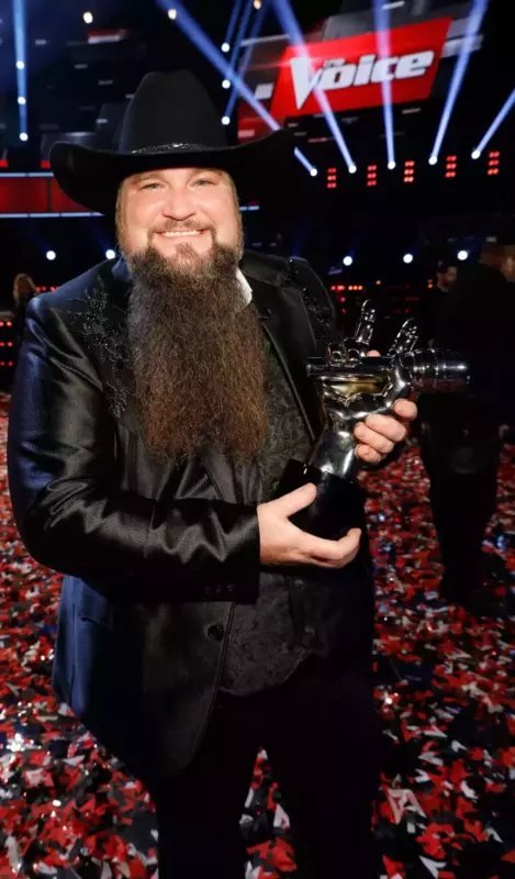After accidentally shooting himself, the Voice Winner Sundance Head is in stable condition, saying, It happened so fast